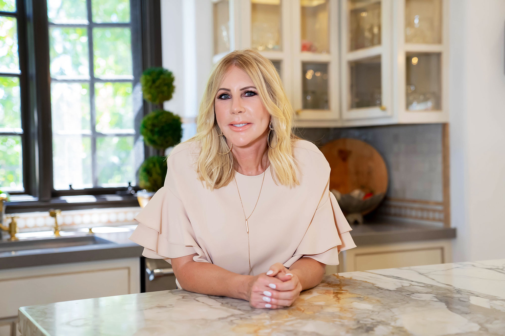 Vicki Gunvalson plastic surgery