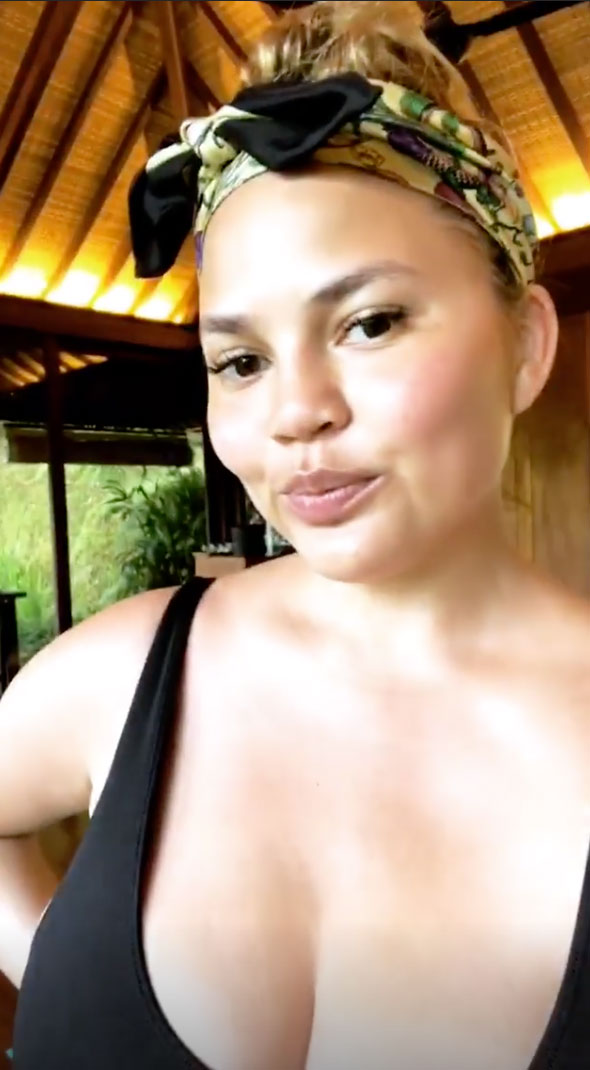 Chrissy Teigen