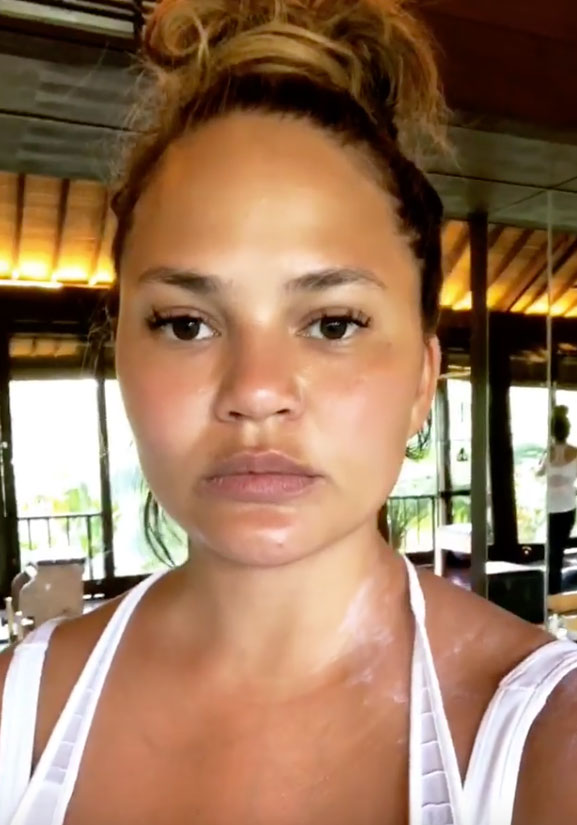 Chrissy Teigen/Instagram