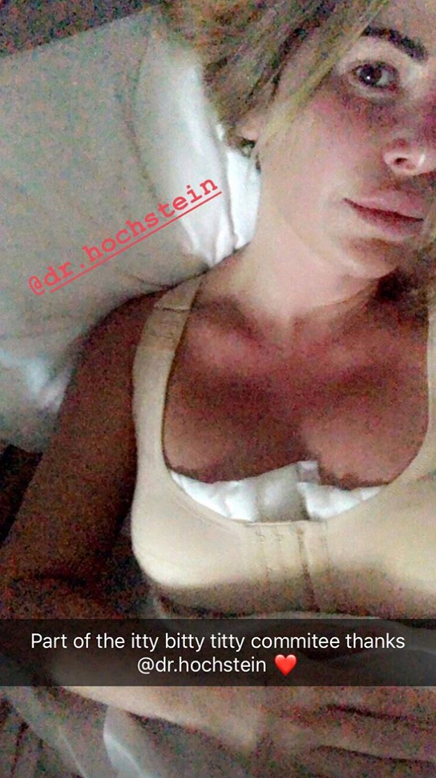 Kim Zolciak Breast Reduction