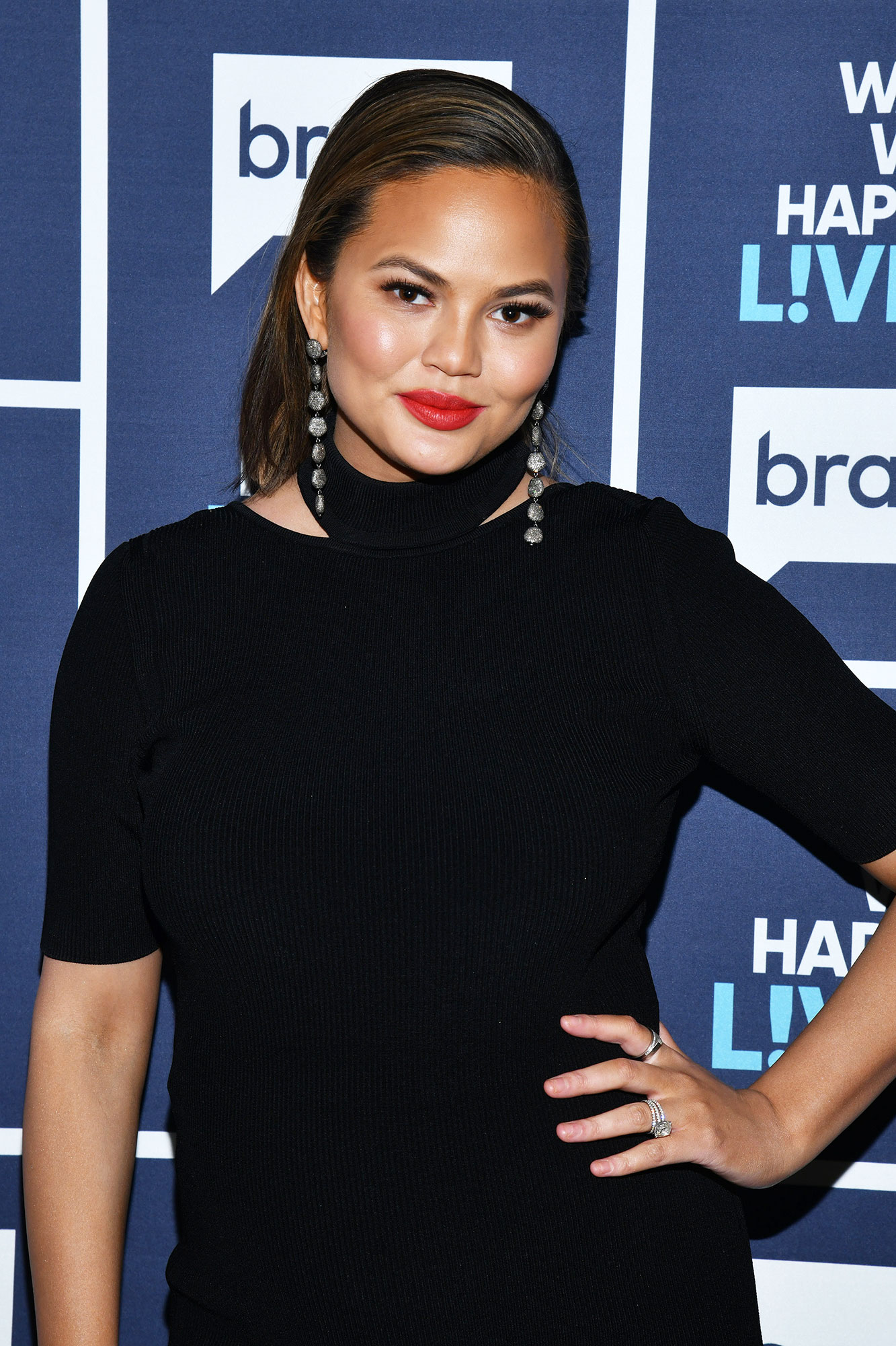 Chrissy Teigen Shows Off Her ‘Thigh Hives’ and ‘Fun’ Stretch Marks