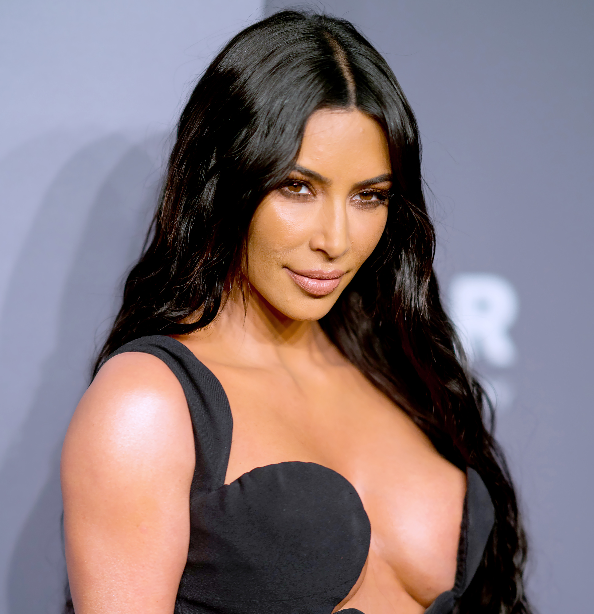 Kim-Kardashian-Psoriasis