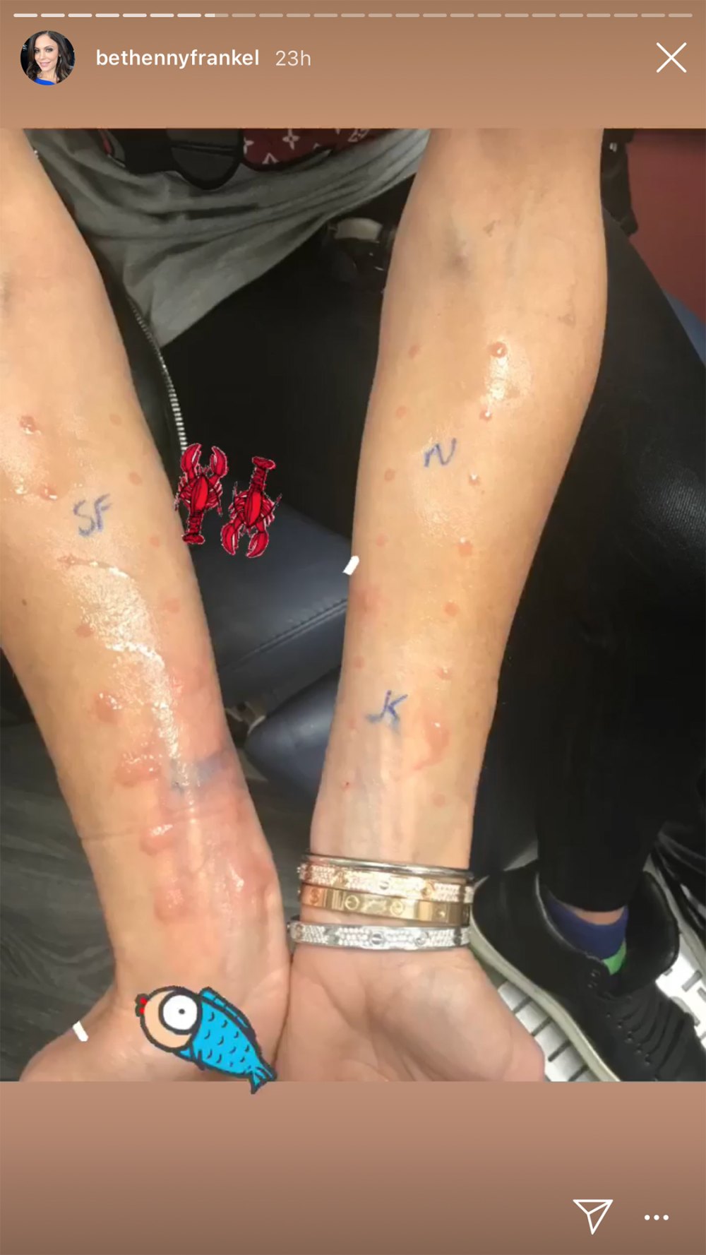 Bethenny Frankel Goes for Allergy Tests After Near-Death Experience: 'It's Fascinating Science'