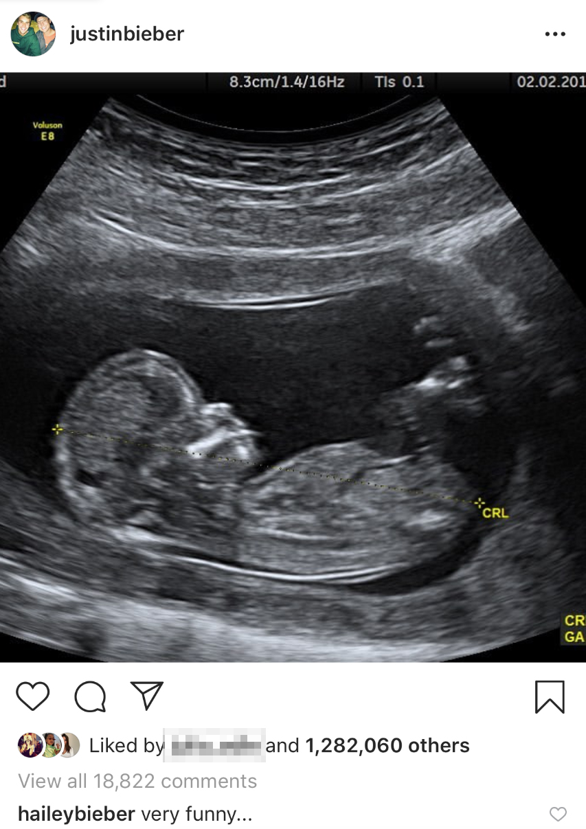 justin-bieber-sonogram-hailey-baldwin