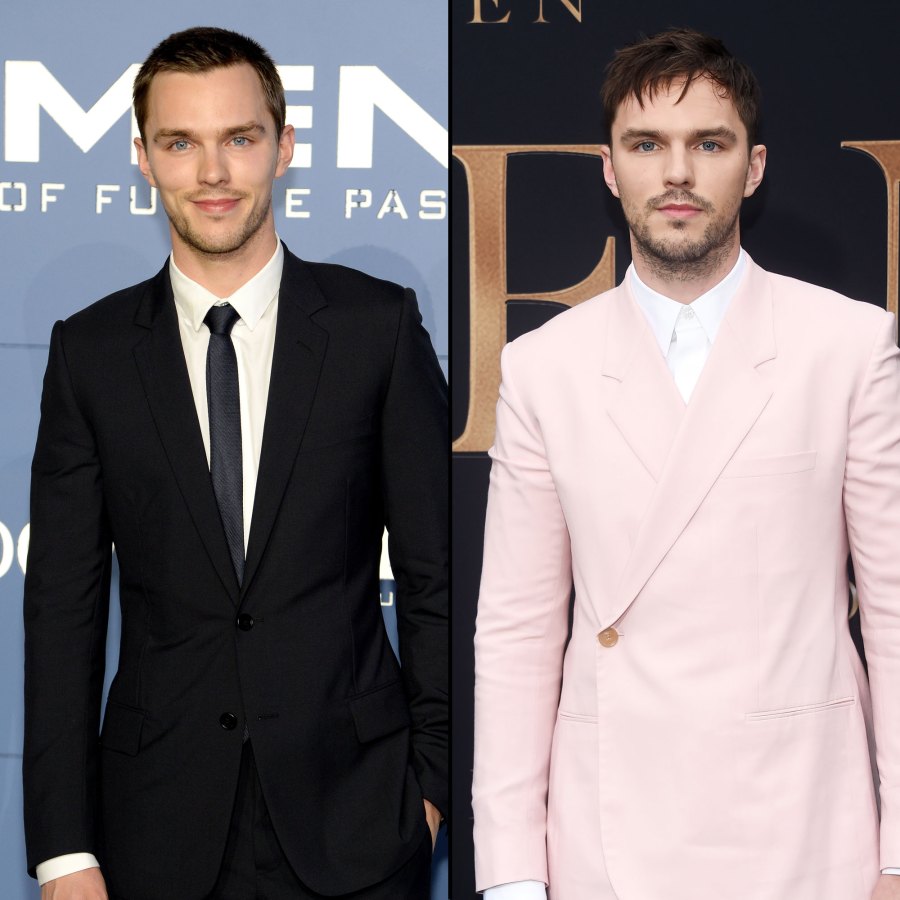 Nicholas Hoult X-Men Then and Now