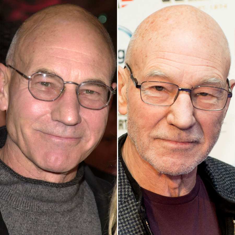 Patrick Stewart X-Men Then and Now