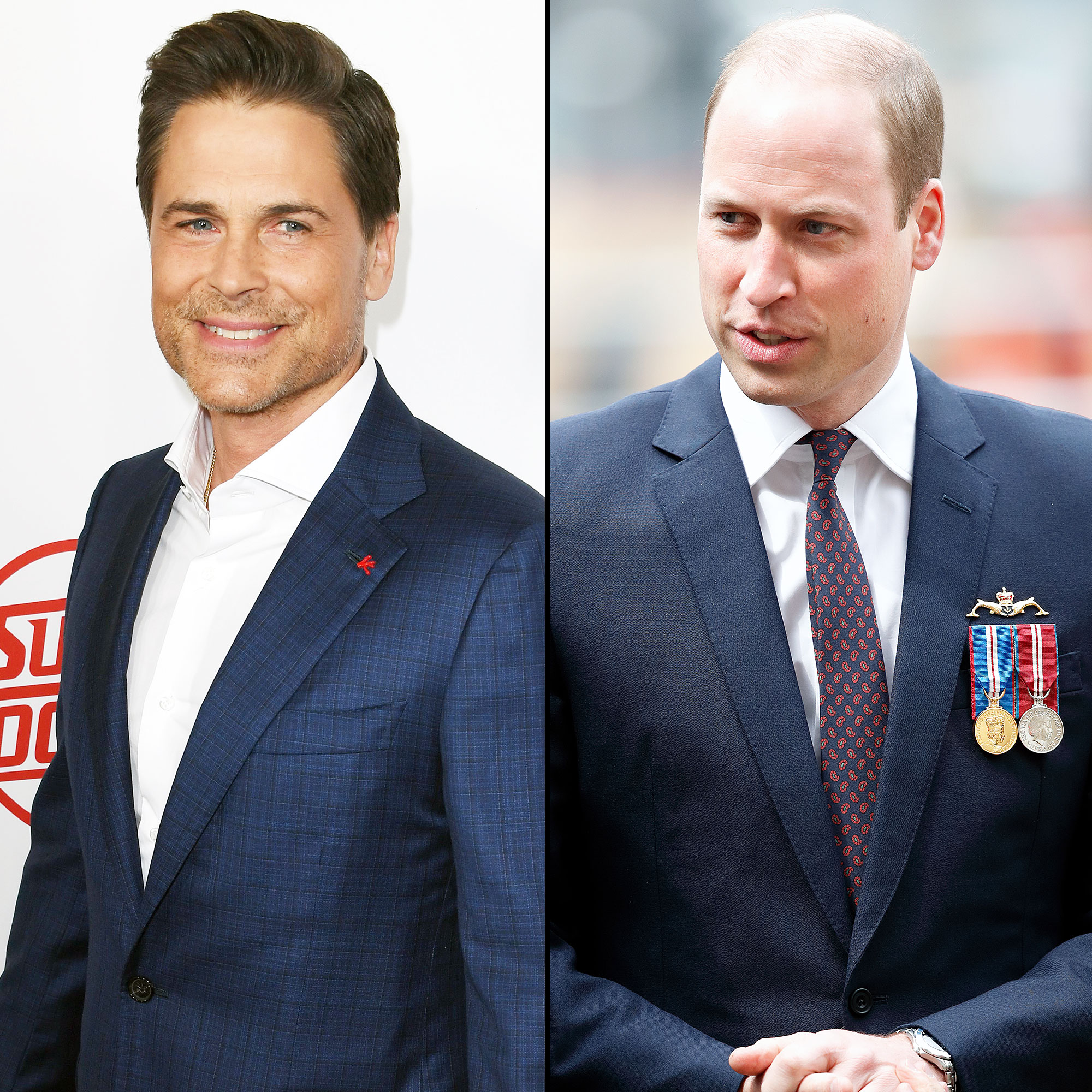 Rob Lowe Prince William Traumatic Hair Loss