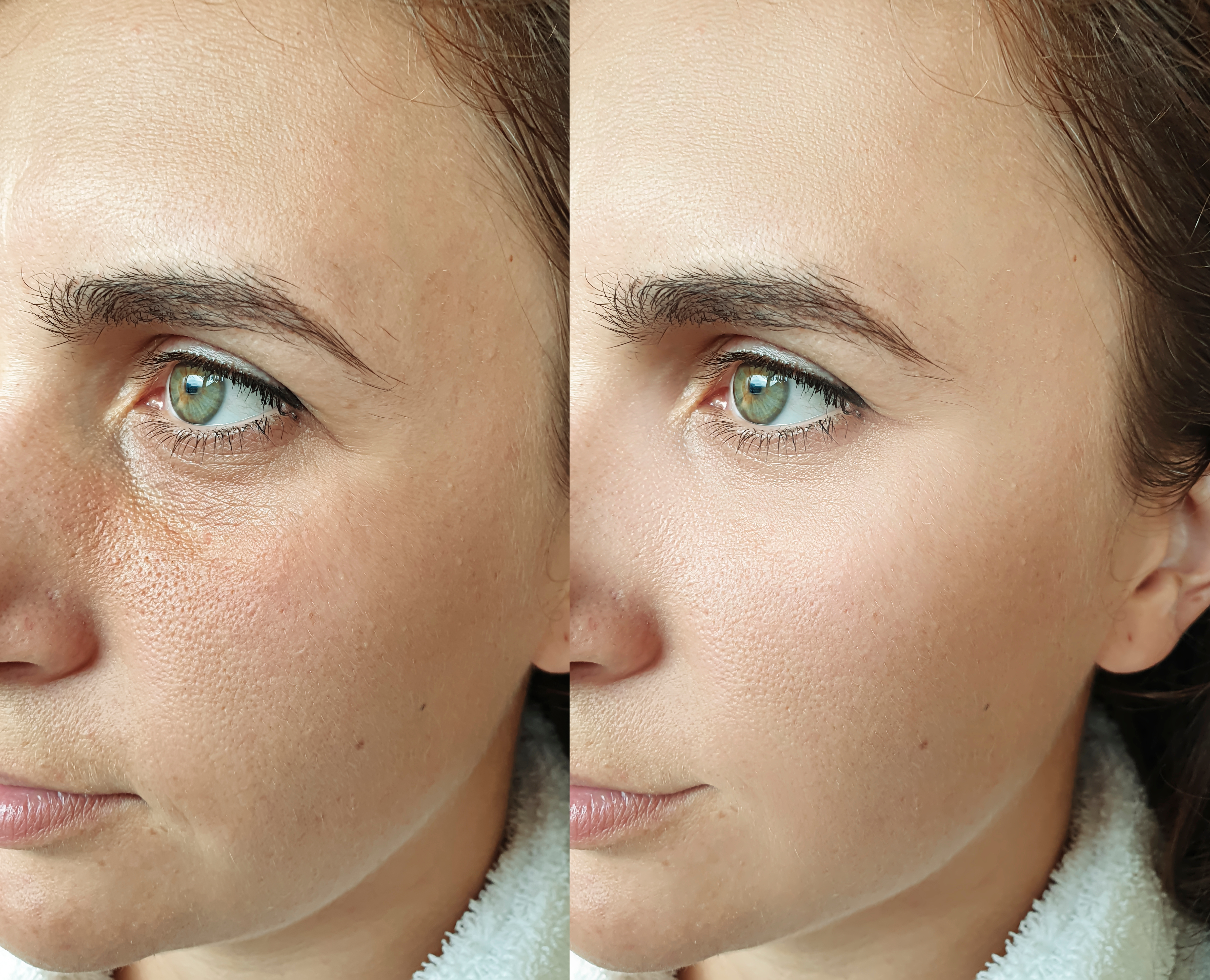 Murad Skincare