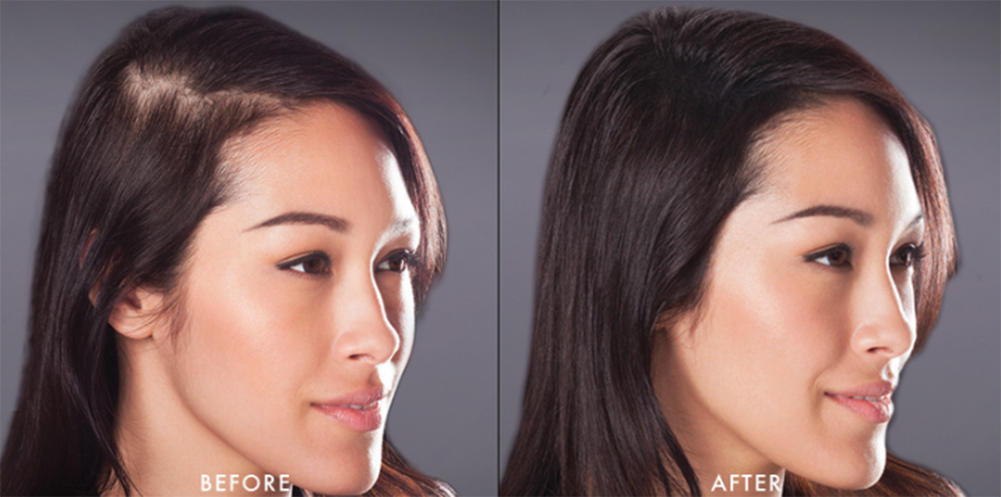before and after