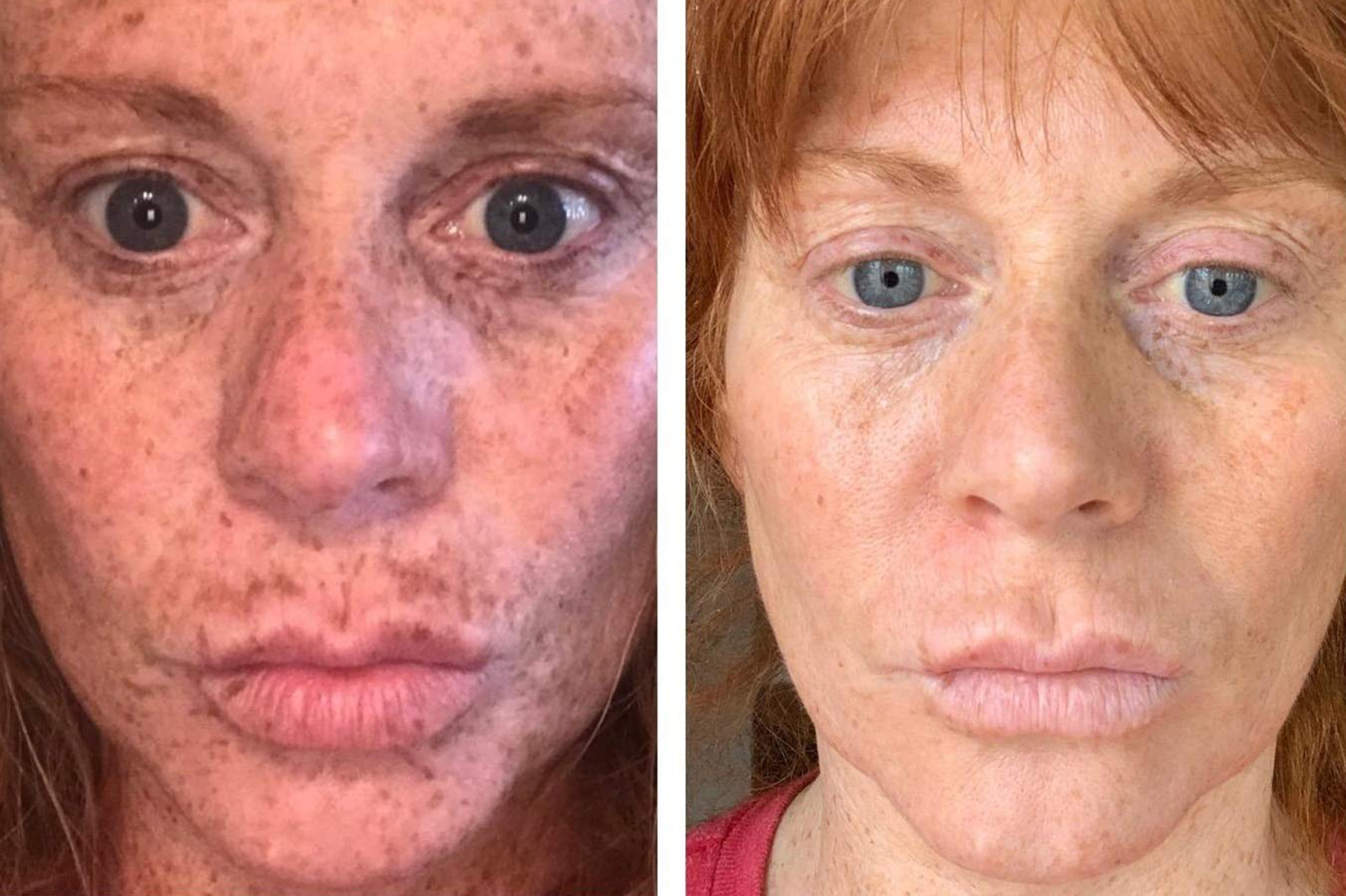 before and after