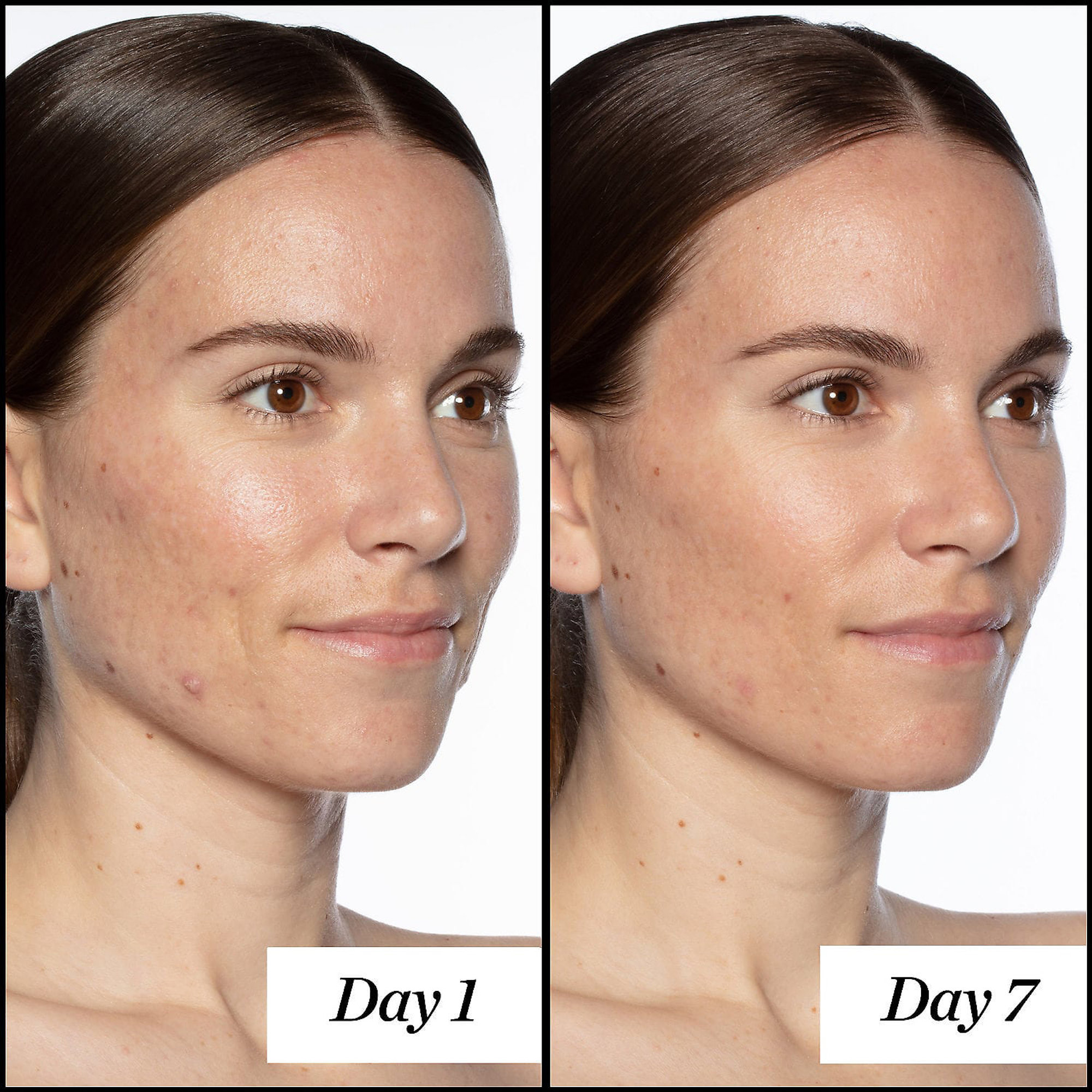Sunday Riley Good Genes Serum Before and After