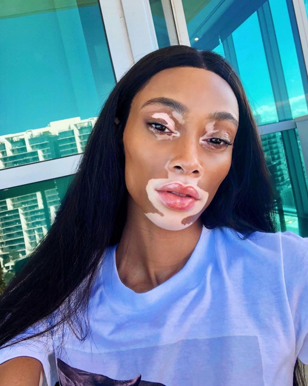 Winnie Harlow On Working With Kim Kardashian