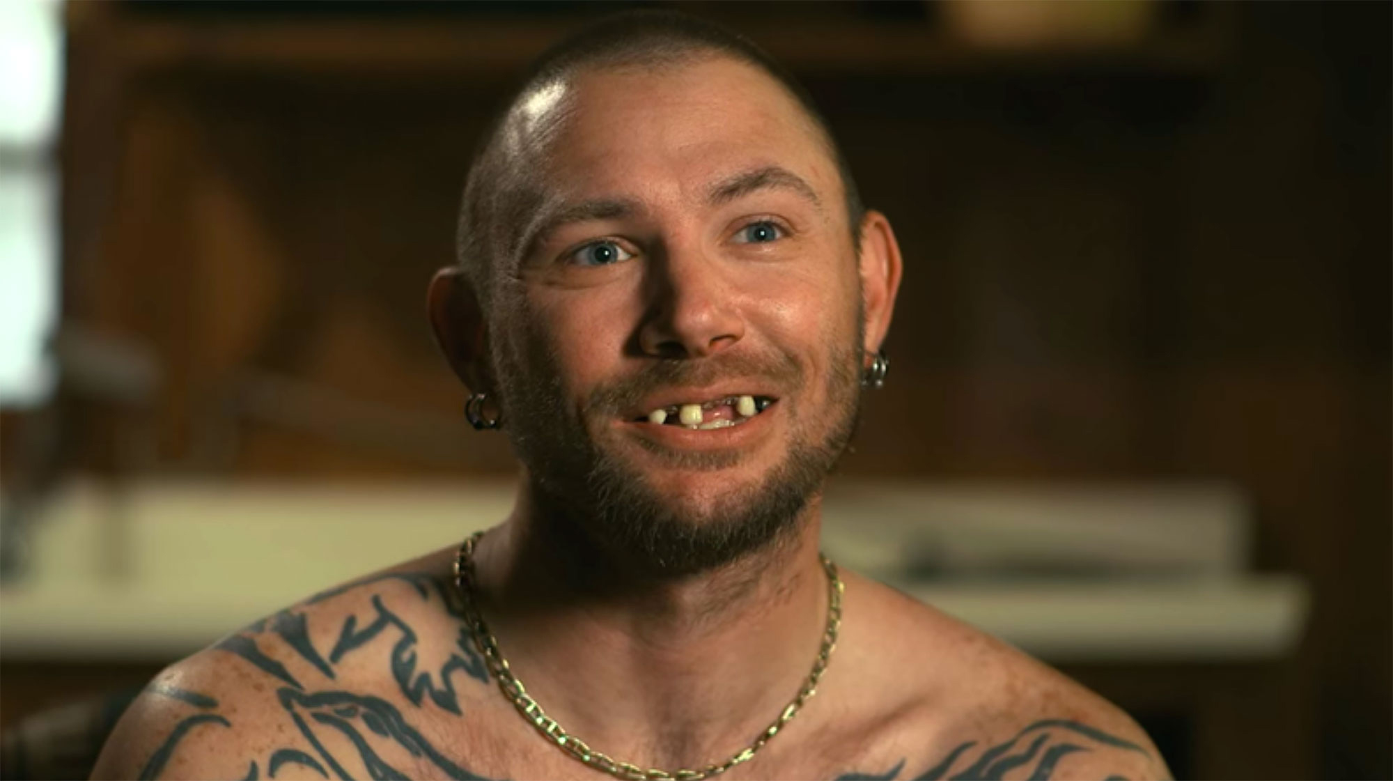 John Finlay before and after new teeth Tiger King 2