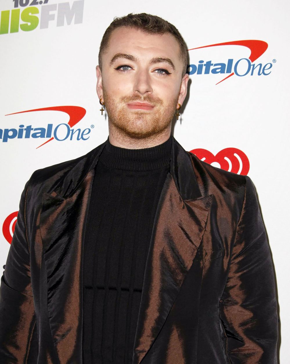 Sam Smith Reveals They Underwent Hair Transplant Surgery