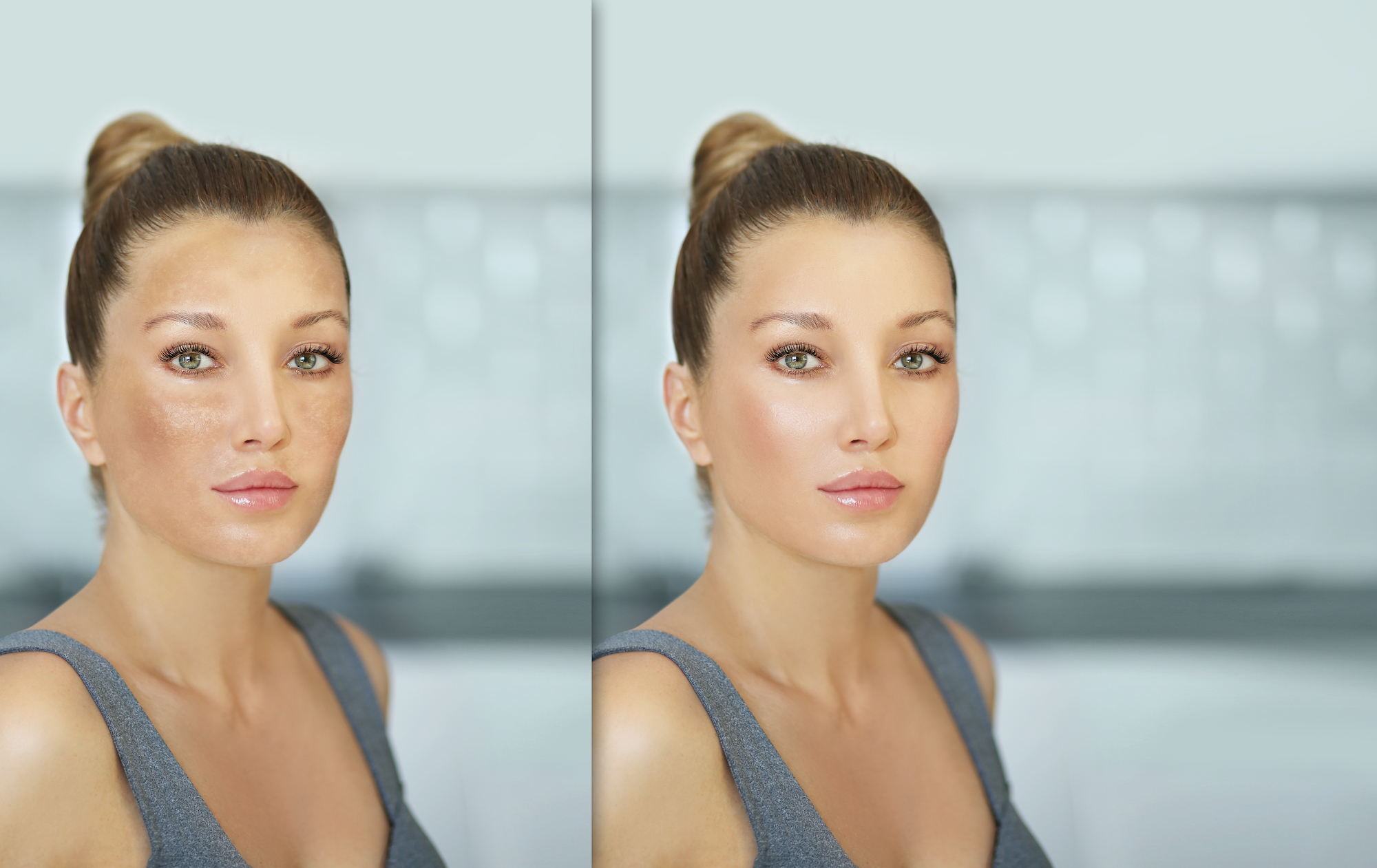 Murad-Before-After
