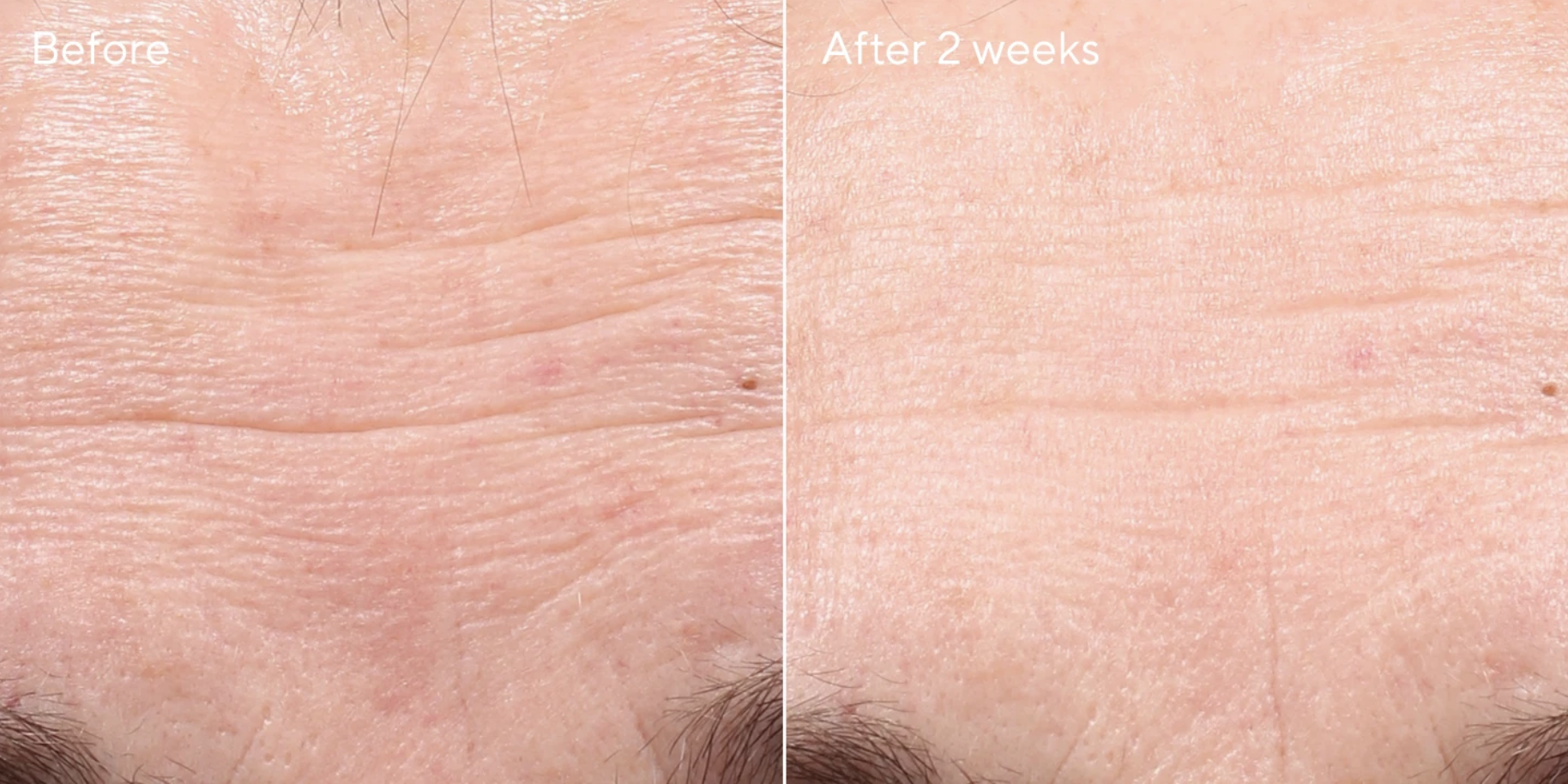 Retinol Youth Renewal Serum