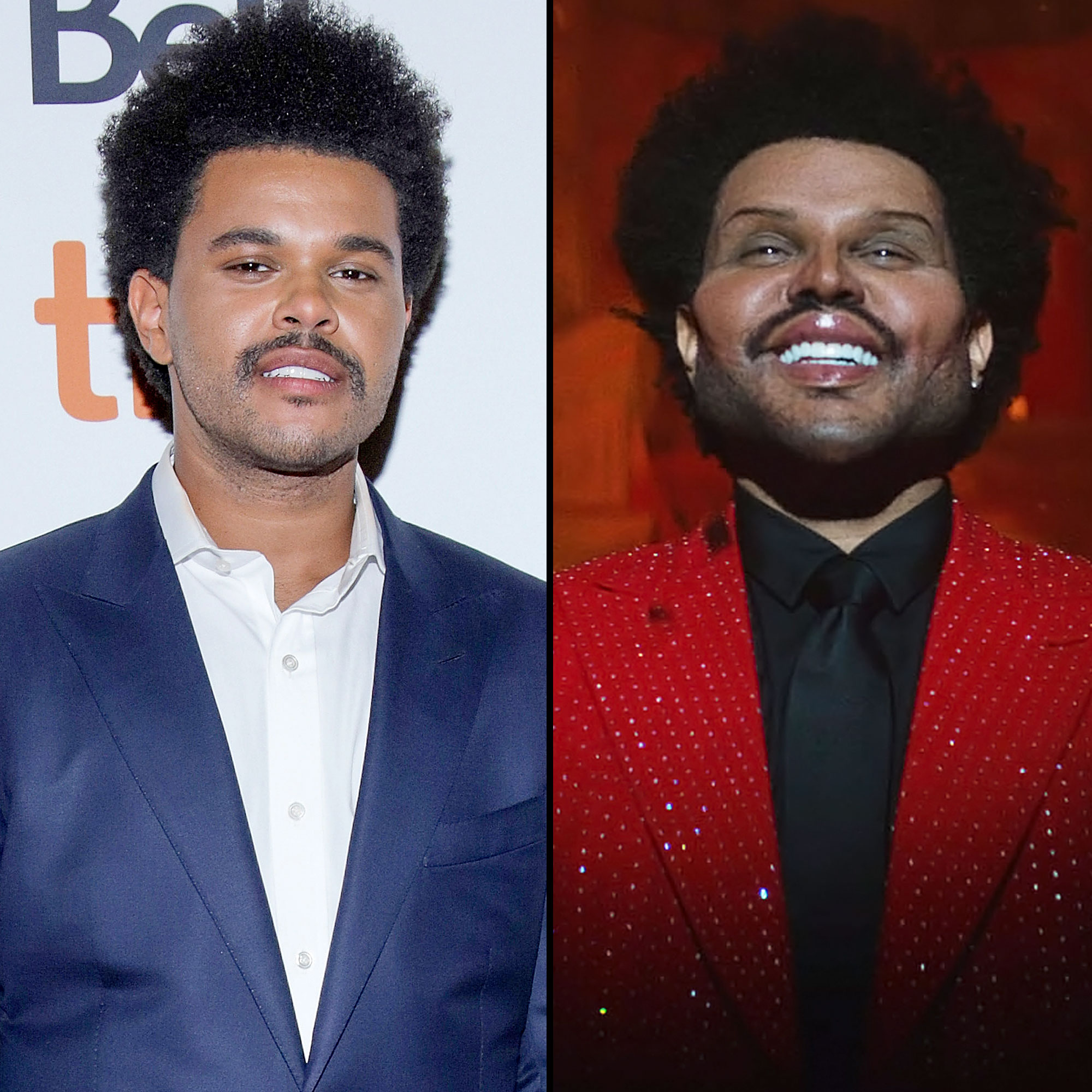 The Weeknd Draws Plastic Surgery Rumors After His New Look Music Video