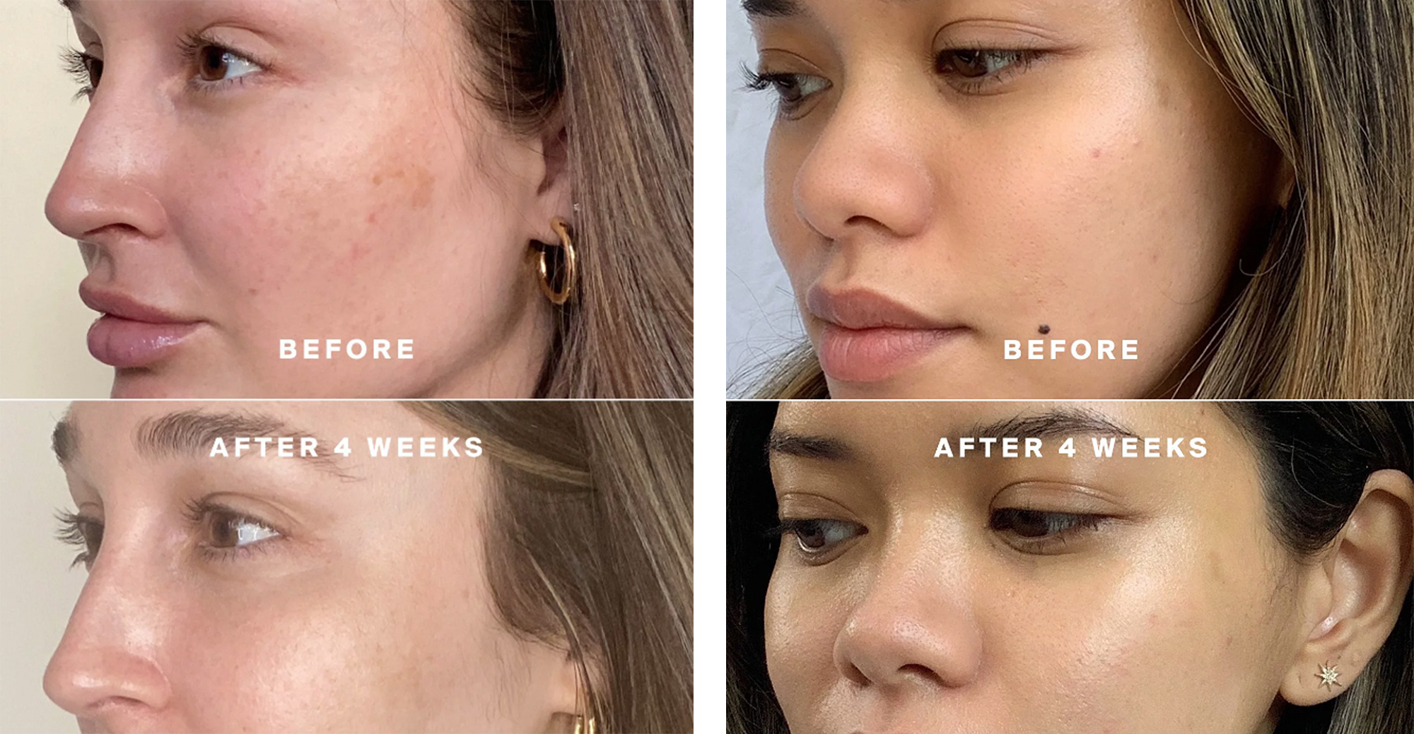 supergoop-before-after