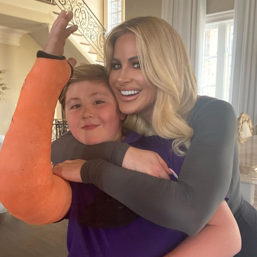 Kim Zolciak’s Son Kash Breaks Arm