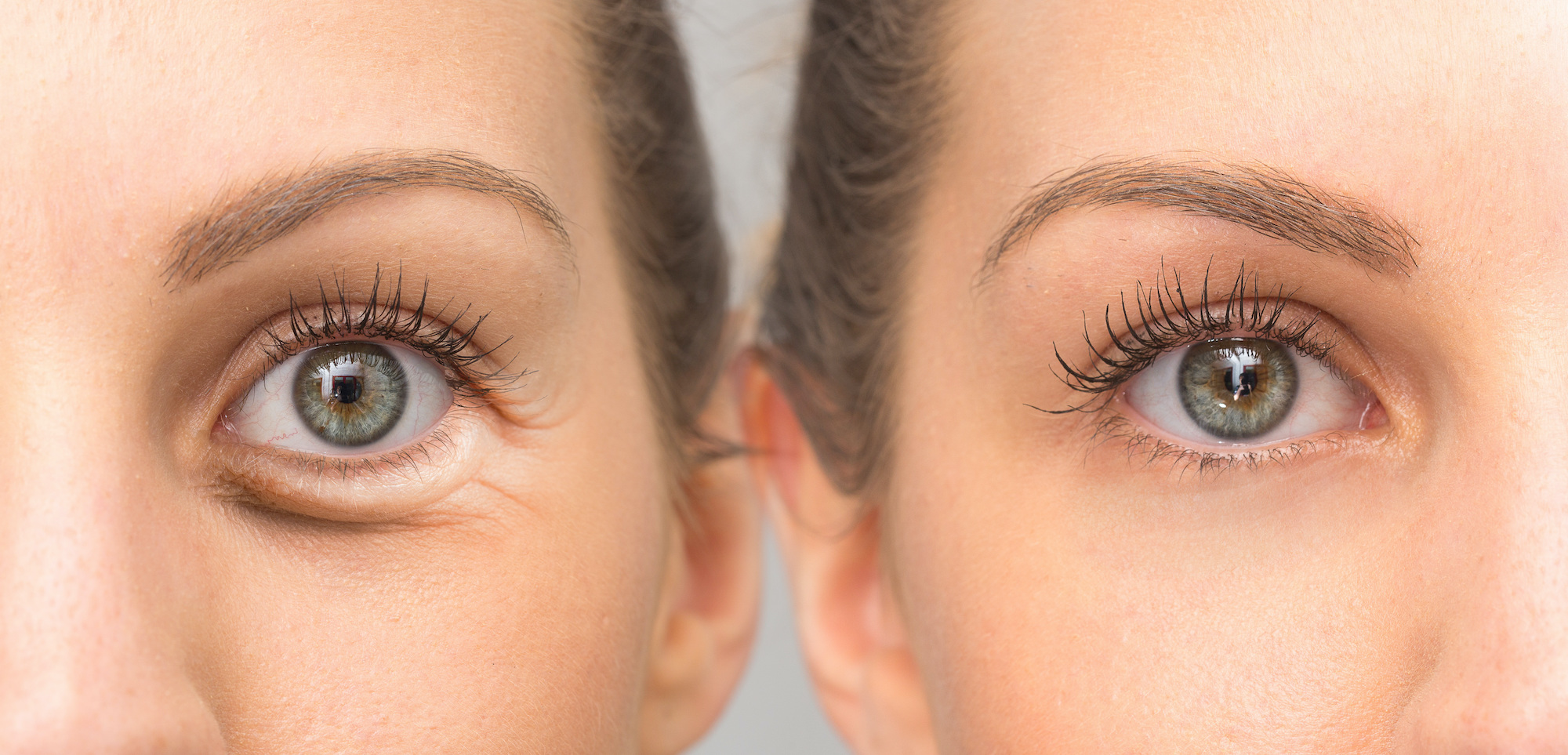 Before-After-Eye-Cream-Stock-Photo