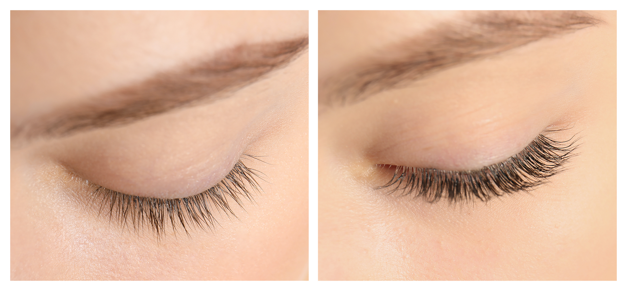 Before-After-Eyelash-Growth-Stock-Photo