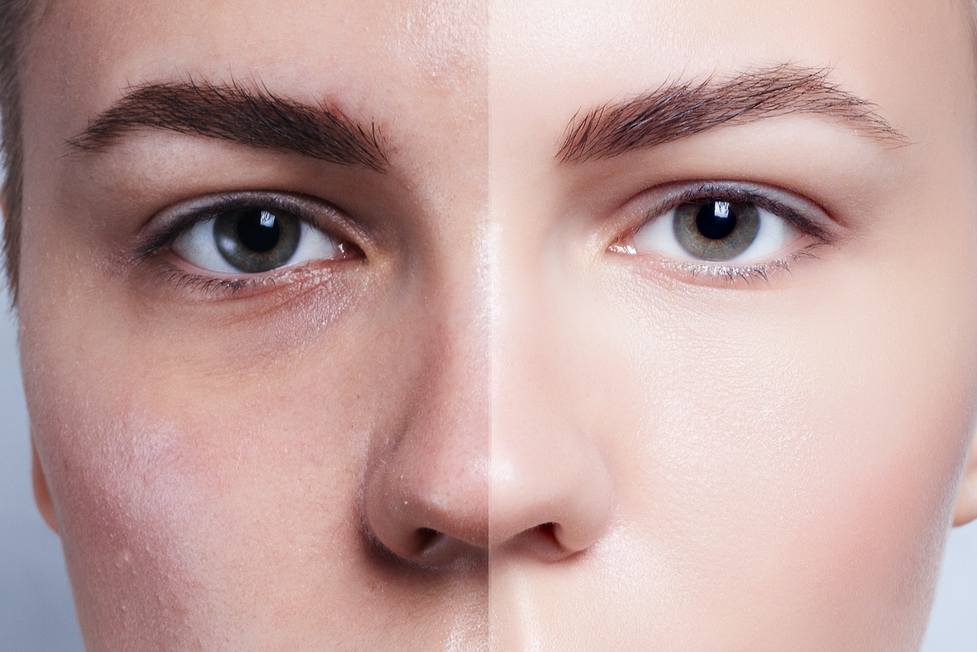 Before-After-Glowing-Skin-Stock-Photo