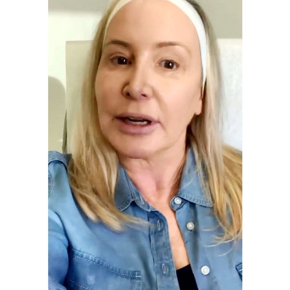 Shannon Beador Is Still Process Fixing Bad Fillers