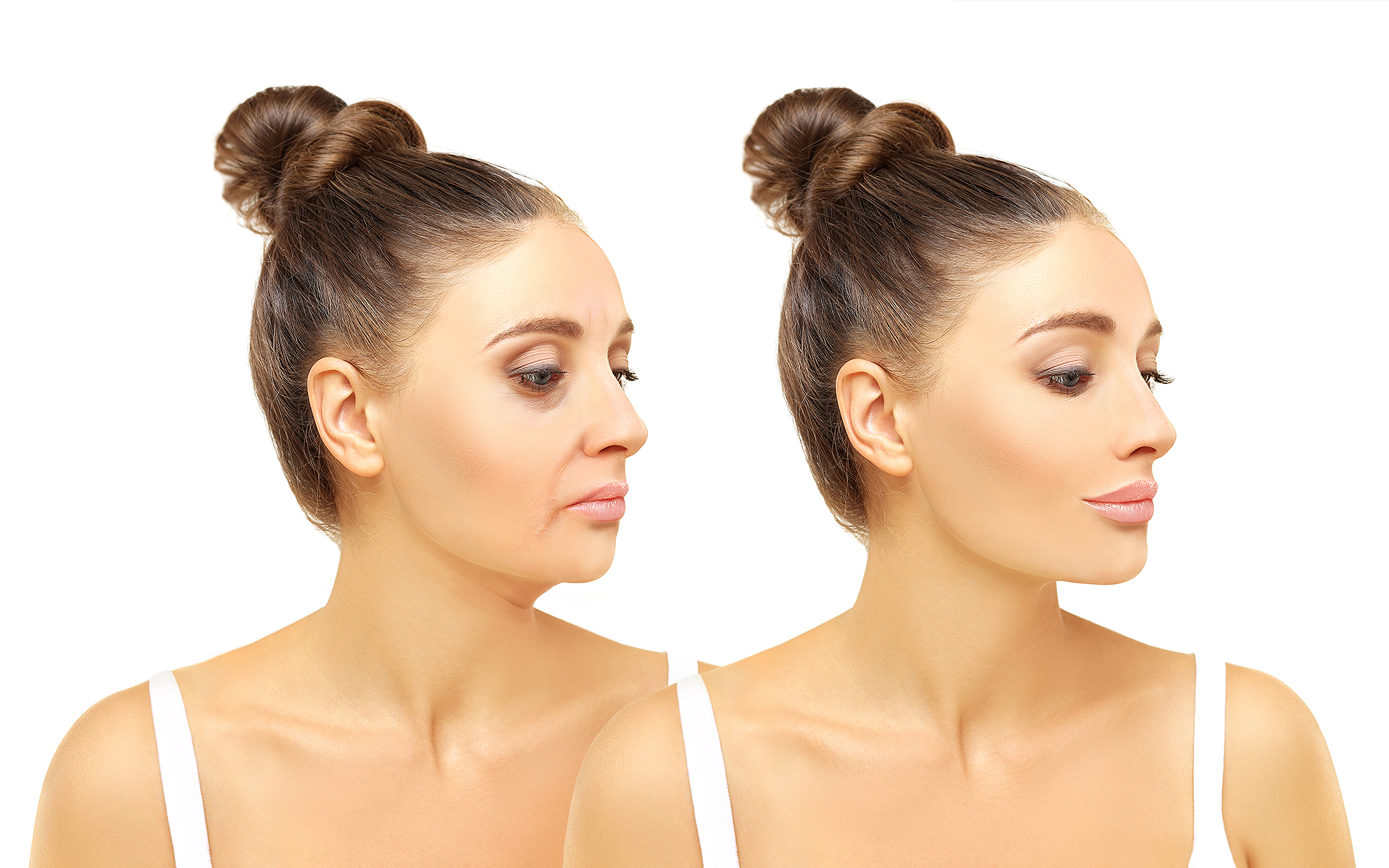 hourglass-serum-anti-aging-before-after