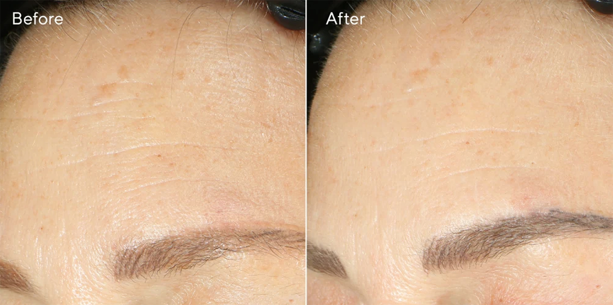 Retinol Youth Renewal Night Cream