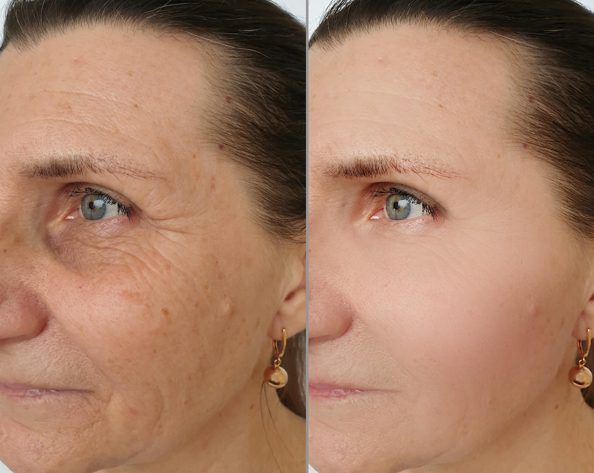 Anti-Aging-Stock-Photo