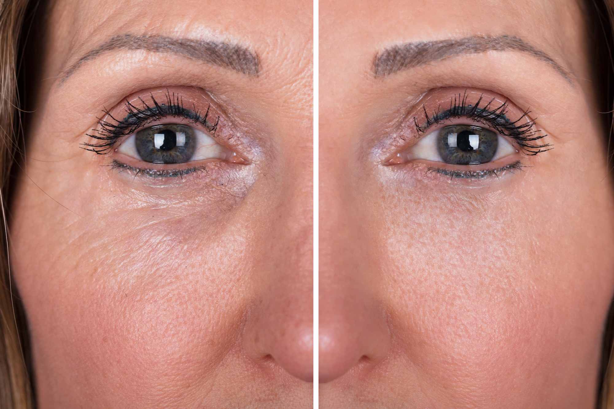 Anti-Aging-Treatment-Stock-Photo