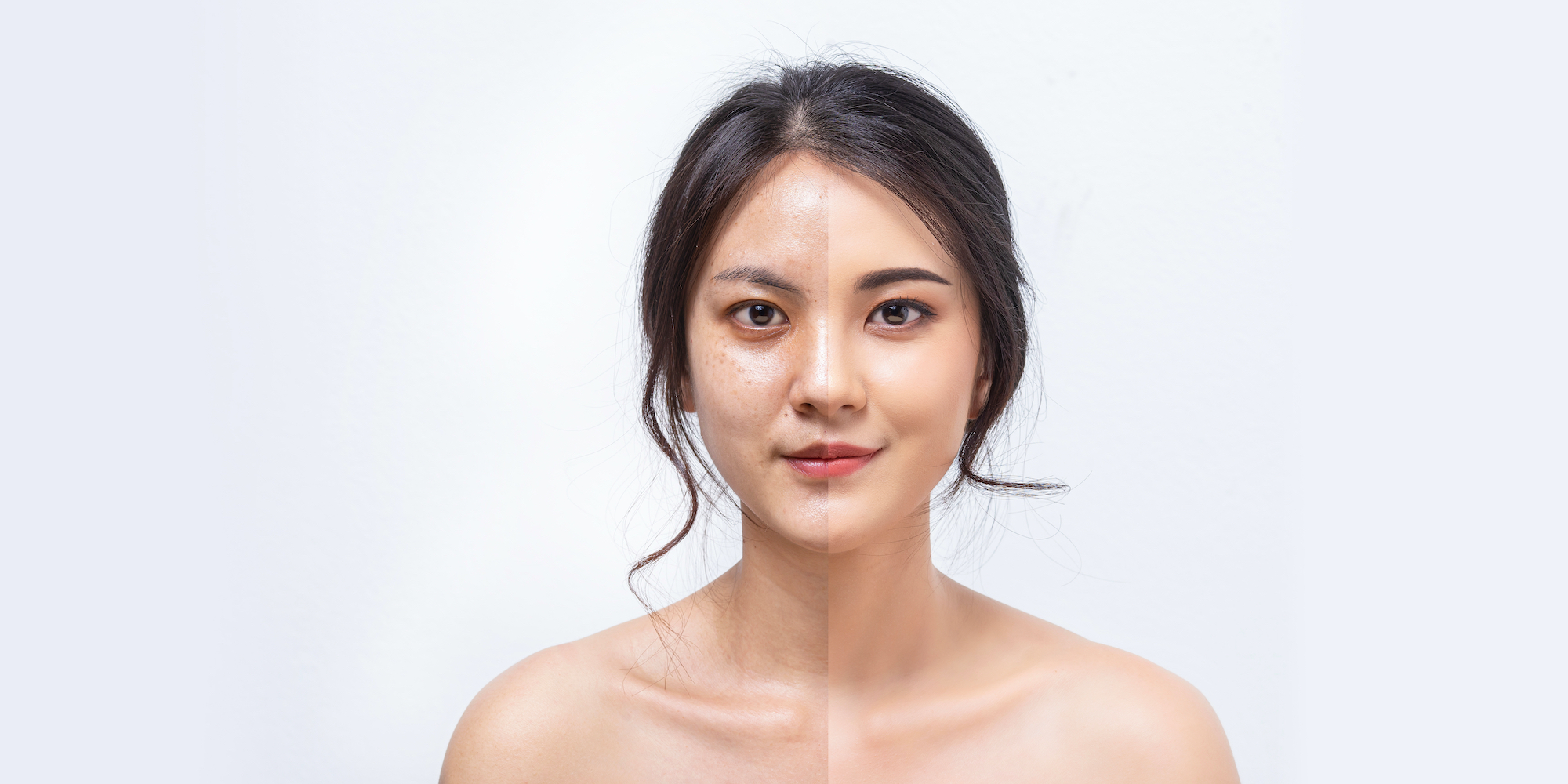 Before-After-Beauty-Stock-Photo