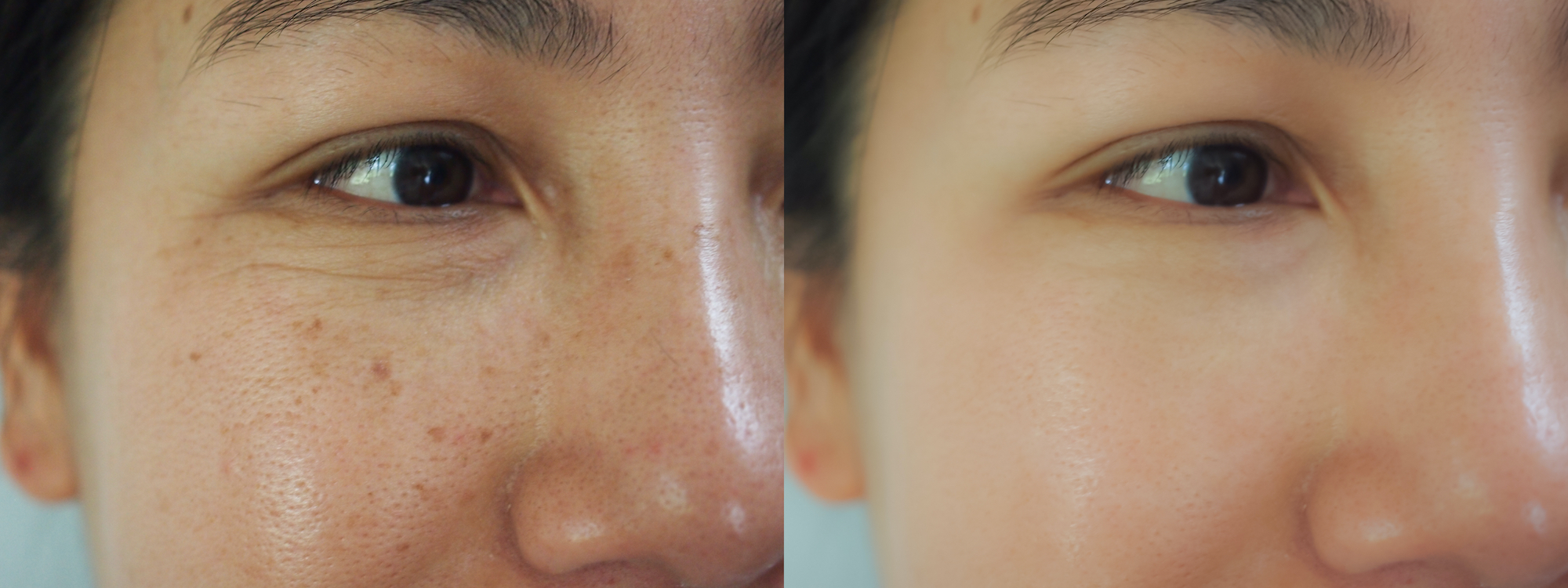 Sun-Spots-Before-After