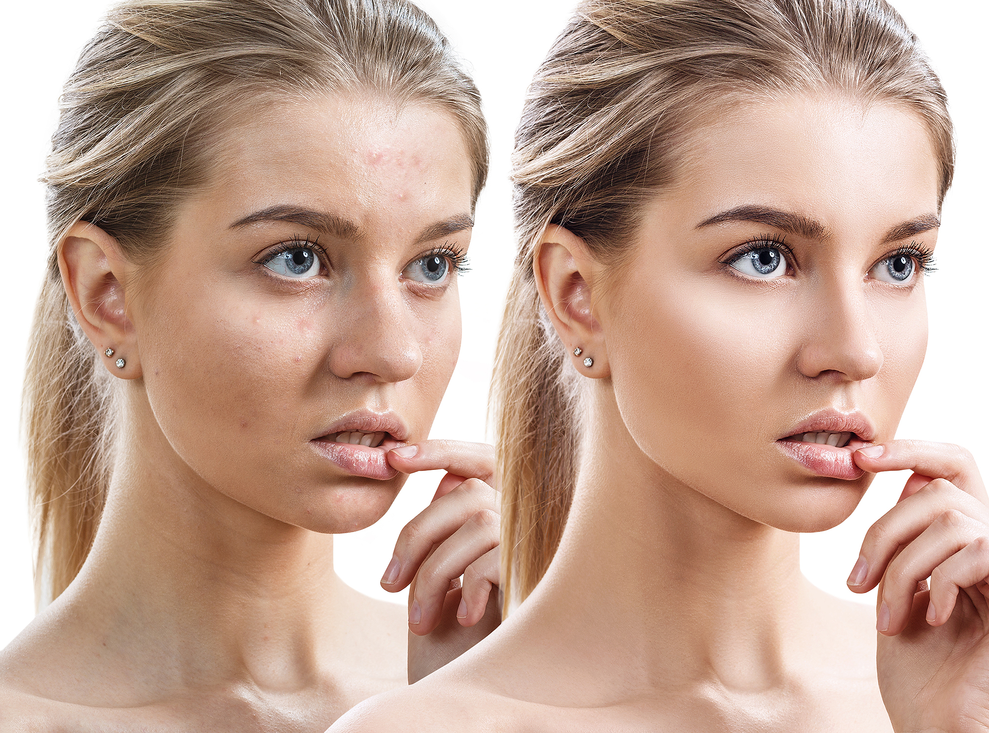 m3-facial-serum-before-after