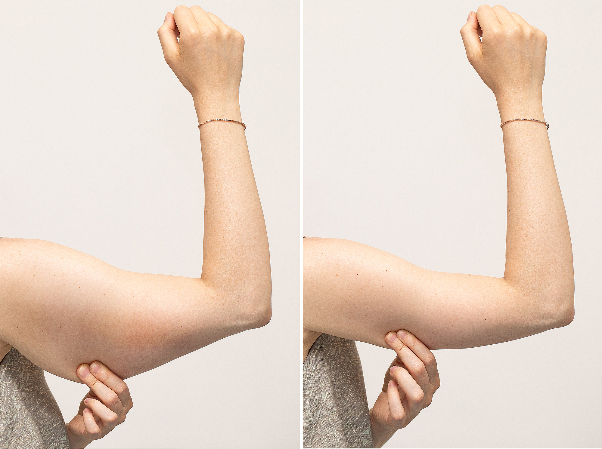 tightening-cream-arms