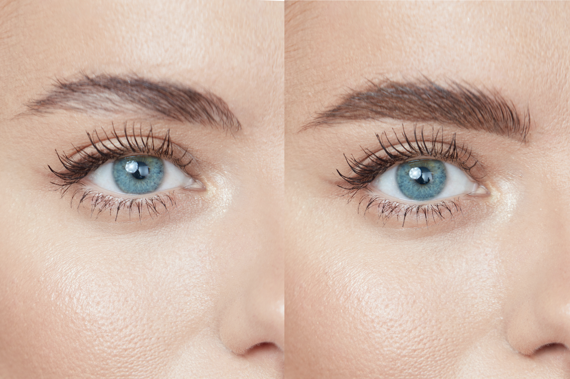 Before-After-Brows