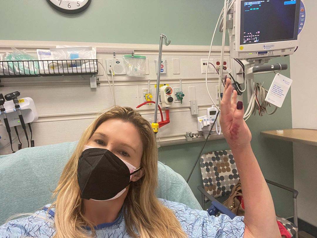 Brandi Glanville Hospitalized Hand Infection I Could Lose Limb