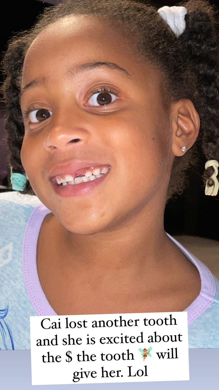 Celeb Parents Show Their Kids' Missing Teeth