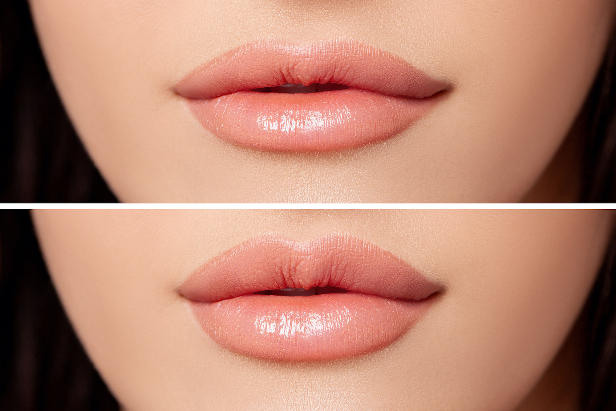 Lip-Treatment-Stock-Photo
