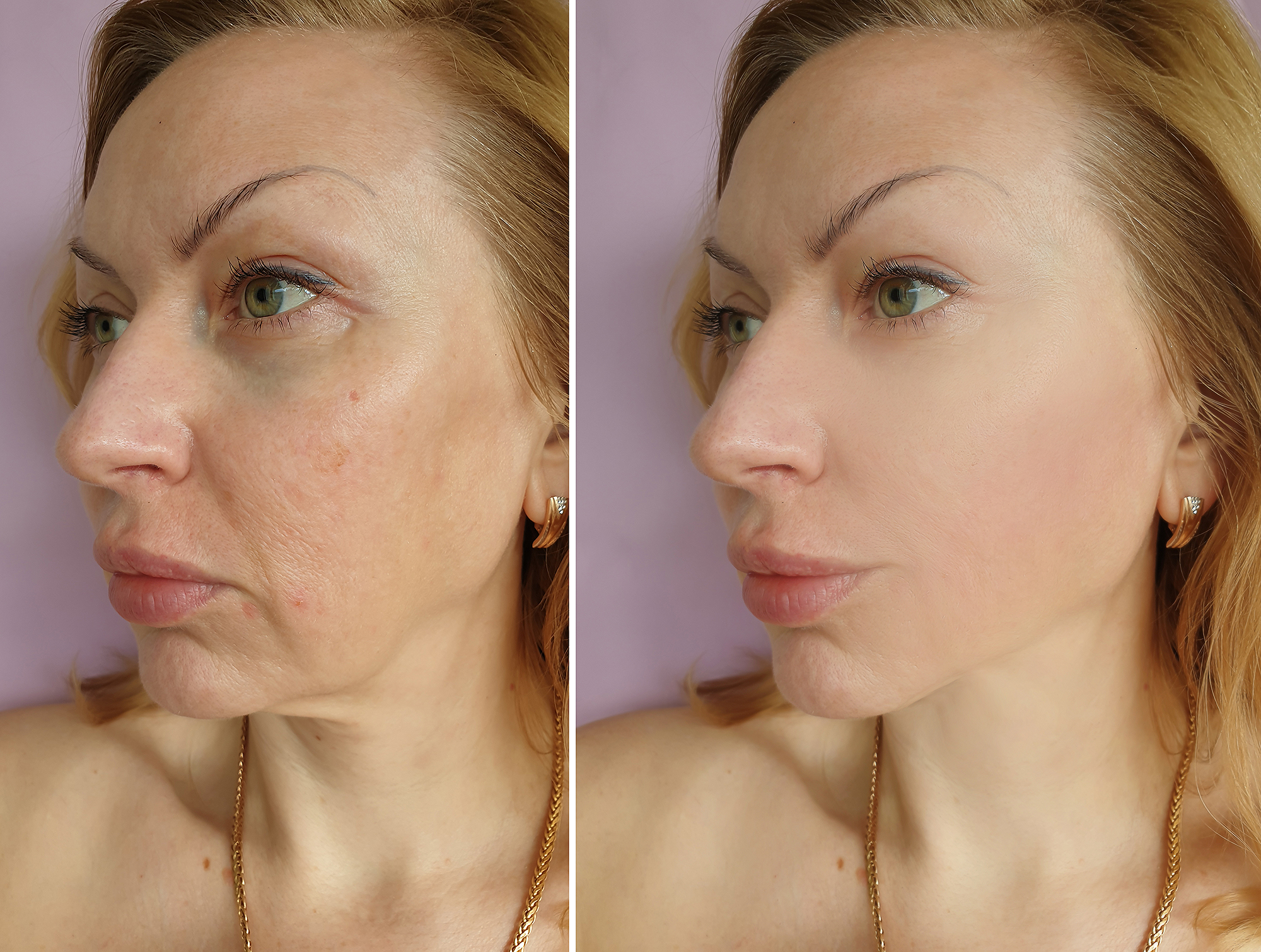 collagen-cream-sagging-skin