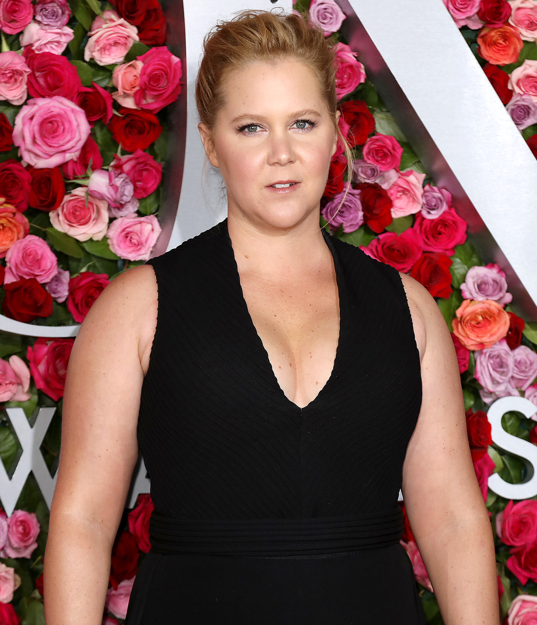 Amy Schumer Details Her Intense Endometriosis Surgery: ‘The Doctor Found 30 Spots’