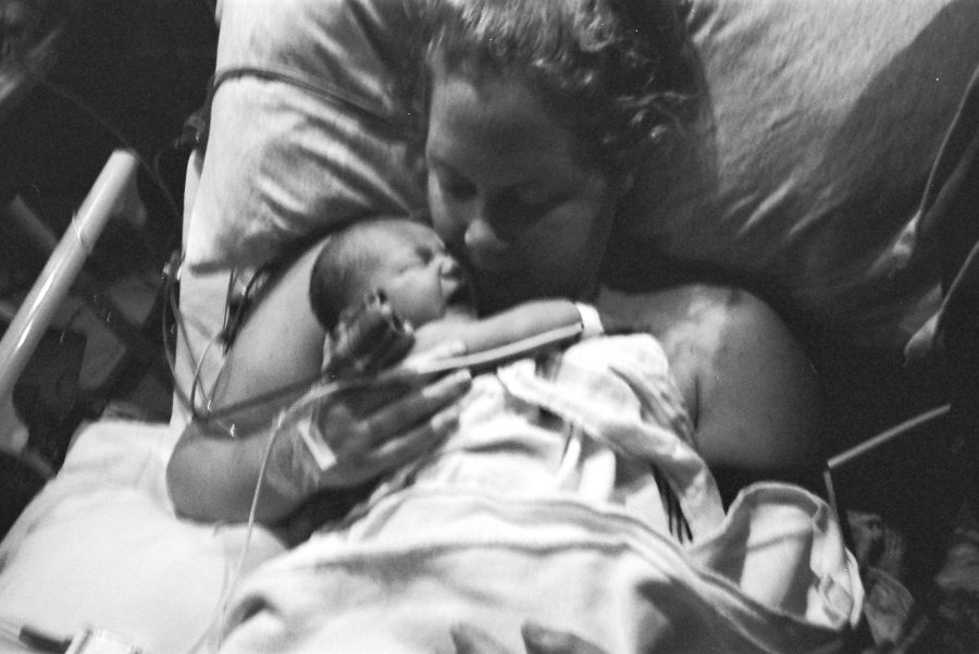 Amy Schumer Moms Reflect on Postpartum in Life After Birth