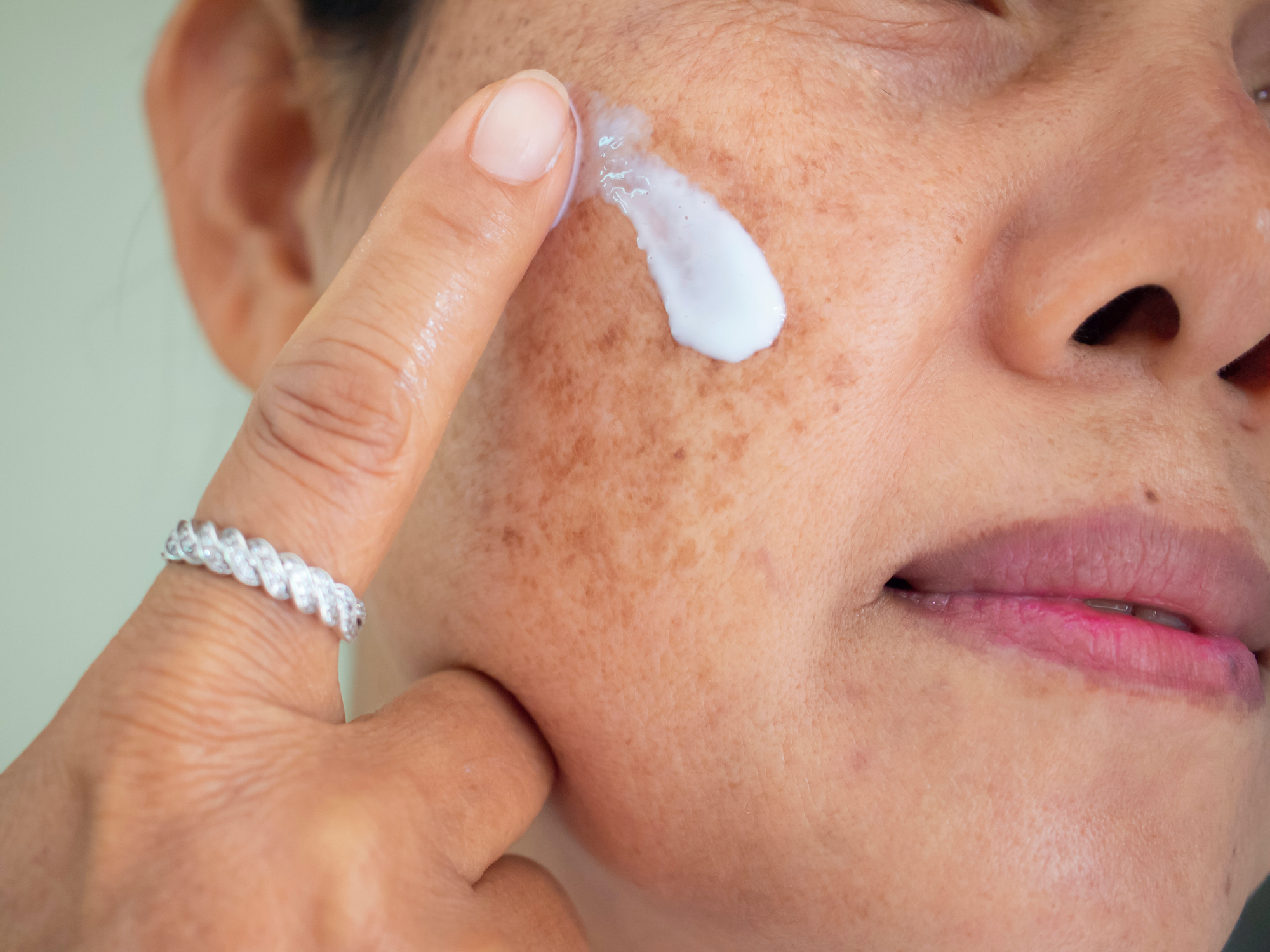 Dark-Spot-Stock-Photo