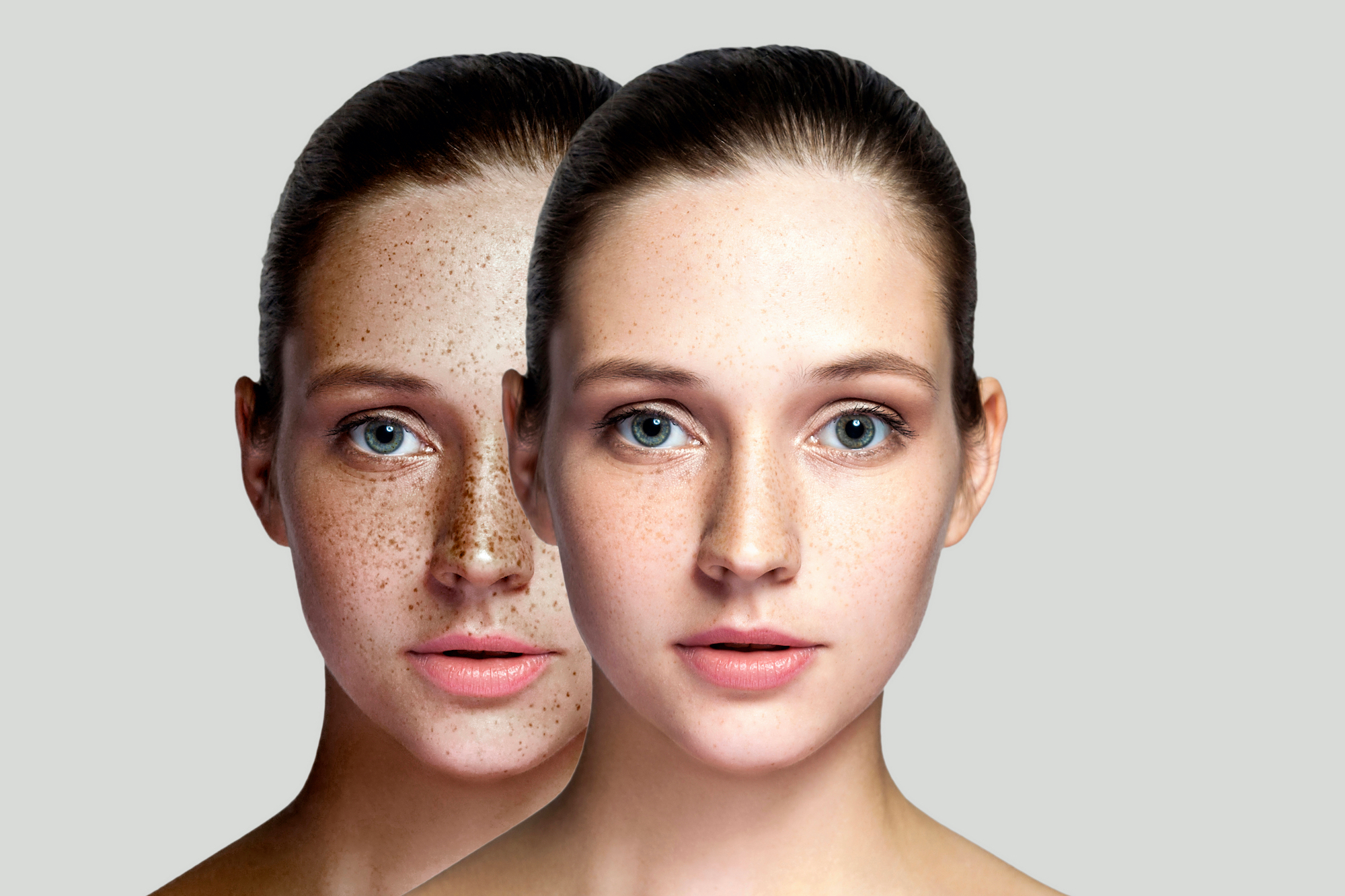 Dark-Spot-Stock-Photo