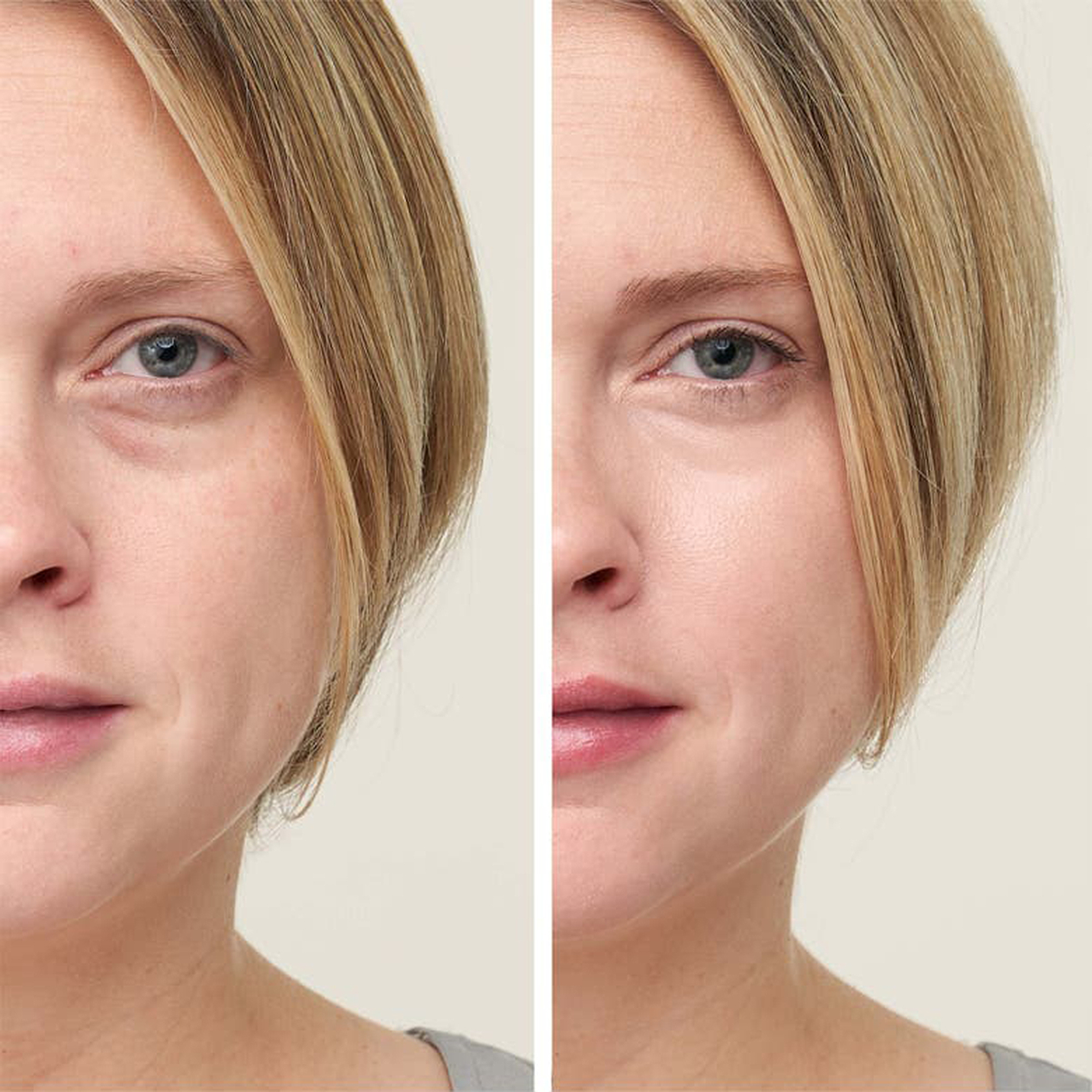 jane-iredale-concealer-before-after
