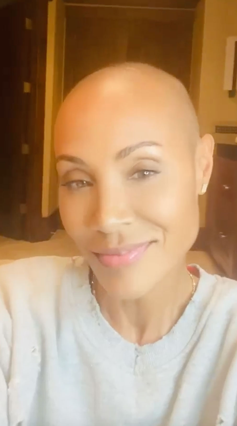 Jada Pinkett Smith Puts a Positive Spin on Hair Loss Me and This Alopecia Are Going to Be Friends