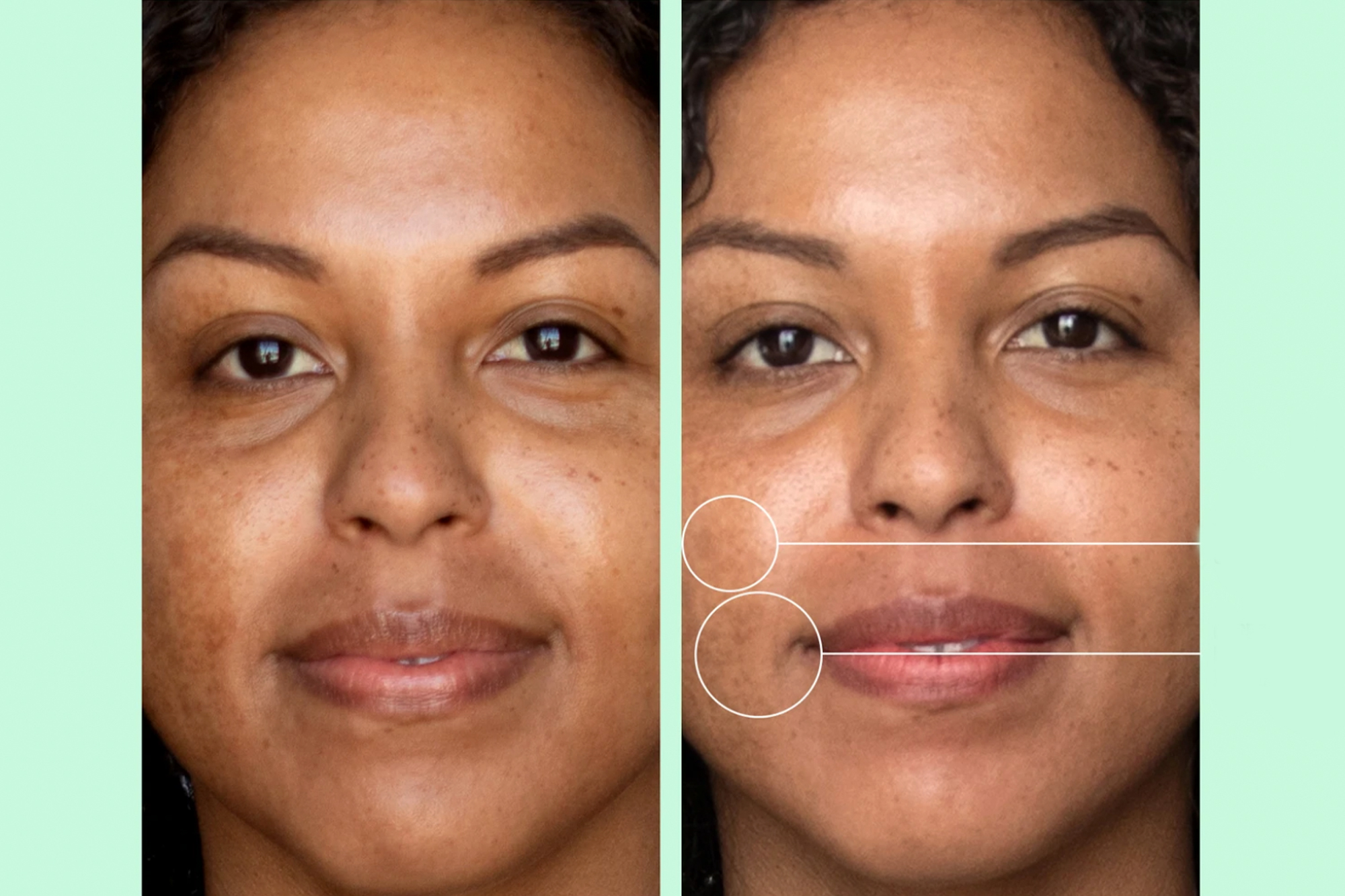 Dark Spots Serum
