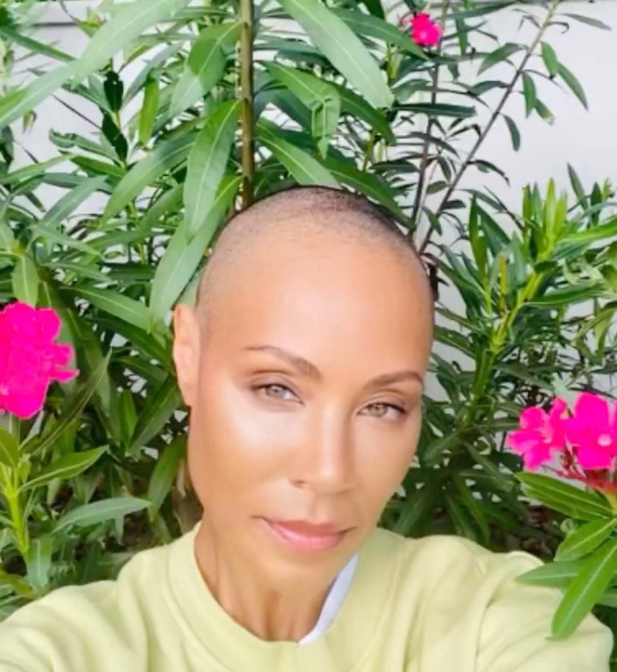 Jada Pinkett Smiths Most Honest Quotes About Alopecia Condition Hair Loss