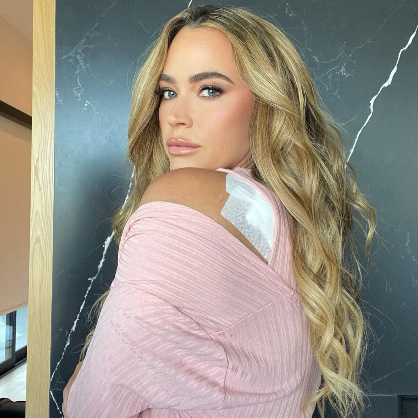 RHOBH Teddi Mellencamp Has a Skin Cancer Scare