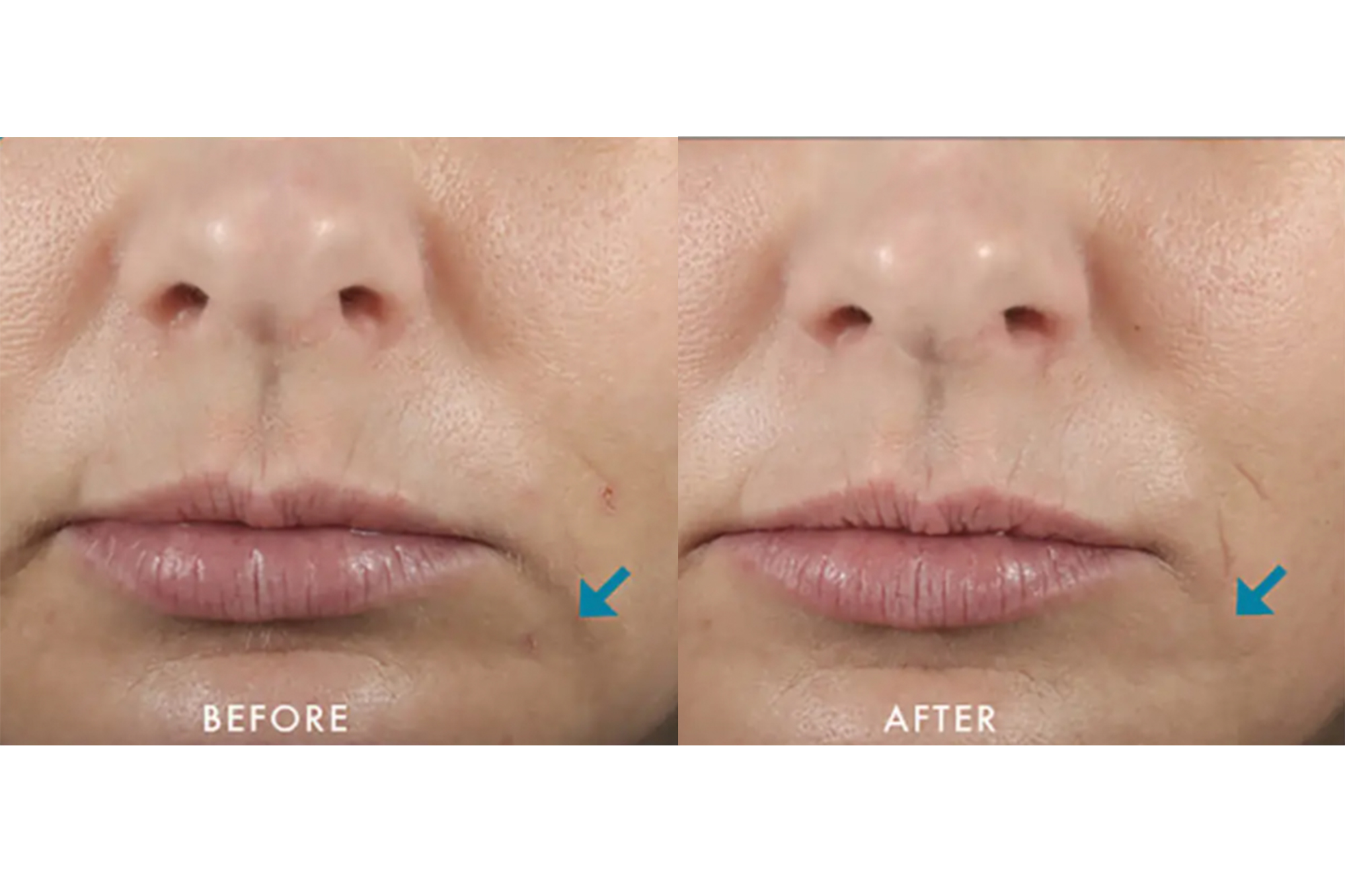 SkinCeuticals Hyaluronic Acid Intensifier